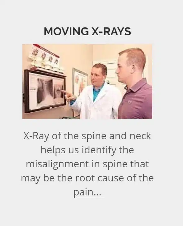Xray Examination at Mil Creek Chiropractic
